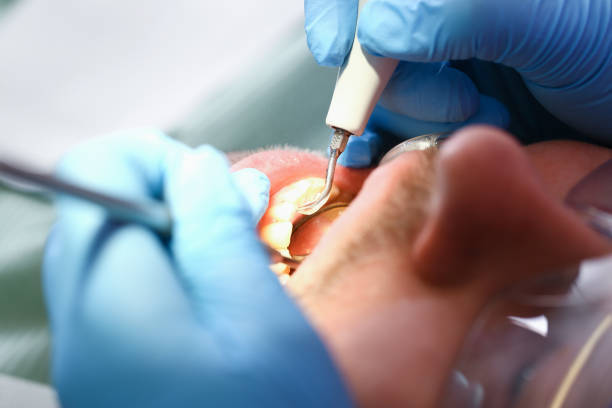 Best Pediatric Emergency Dentist in Lone Tree, IA